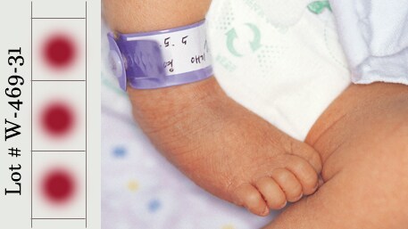 a newborn's foot and blood spots
