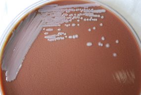 Colonial morphology displayed by gram-negative Burkholderia mallei bacteria, which were grown on a medium of chocolate agar for a 48 hour time period at a temperature of 37° Celsius. Photo source: CDC/Todd Parker, PhD