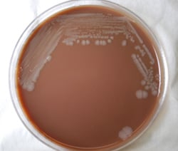 Colony morphology displayed by Gram-negative Burkholderia mallei bacteria, which was grown on a medium of chocolate agar, for a 72 hour time period, at a temperature of 37°C.