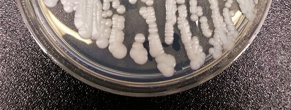 Strain of <em>Candida auris</em> cultured in a petri dish at the Centers for Disease Control and Prevention (CDC). Photo: Shawn Lockhart