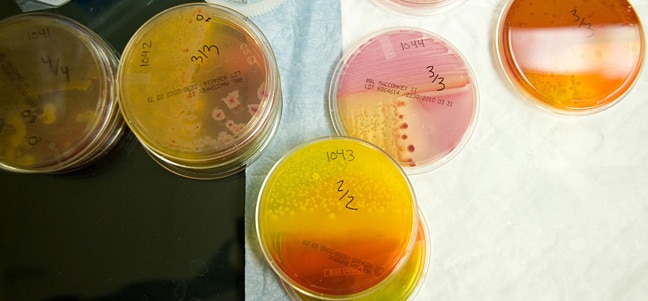 Petri dishes showing microbe growth