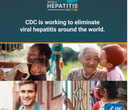CDC Working to Eliminate Viral Hepatitis Globally
