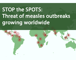 world map of measles hotspots