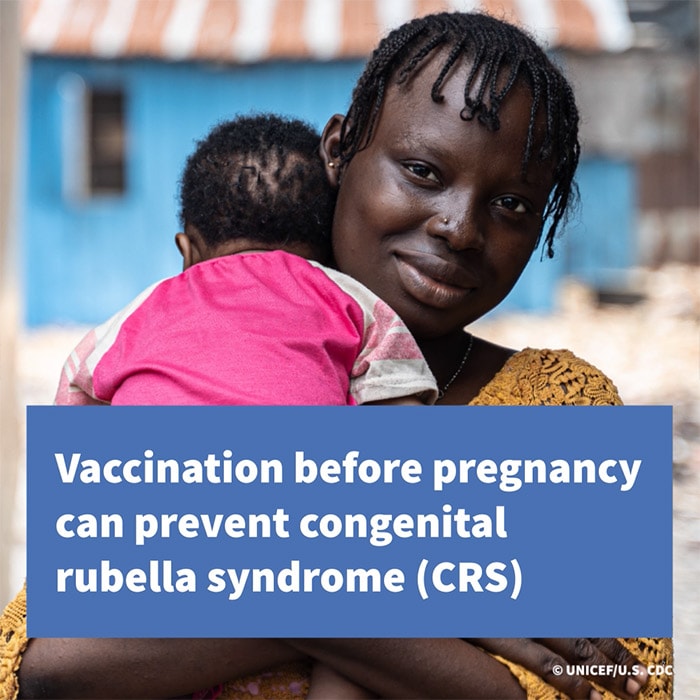 Vaccination before pregnancy can prevent congenital rubella syndrome (CRS)