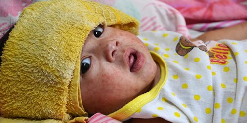 Progress Towards Regional Measles Elimination