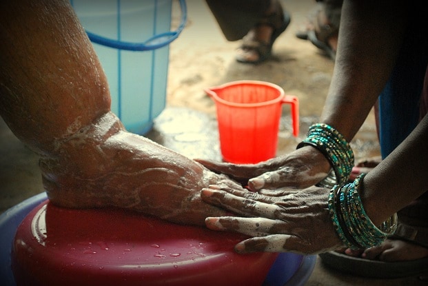 Care for the neglected—How CDC helps those with lymphatic filariasis