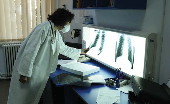 Medical professional reviews x-rays to diagnose TB infection. Credit: Tom Maguire.
