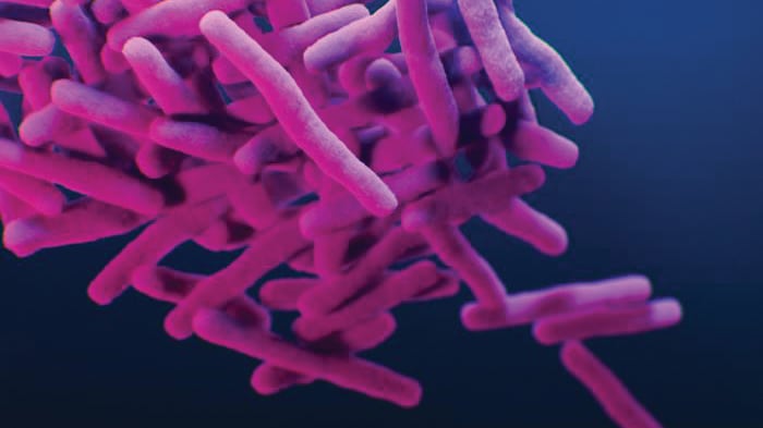 Drug-resistant Mycobacterium tuberculosis, CDC