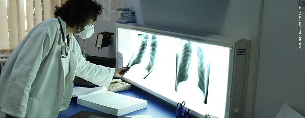 lab worker examines x-ray