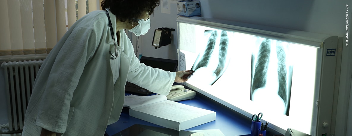 lab worker examines x-ray
