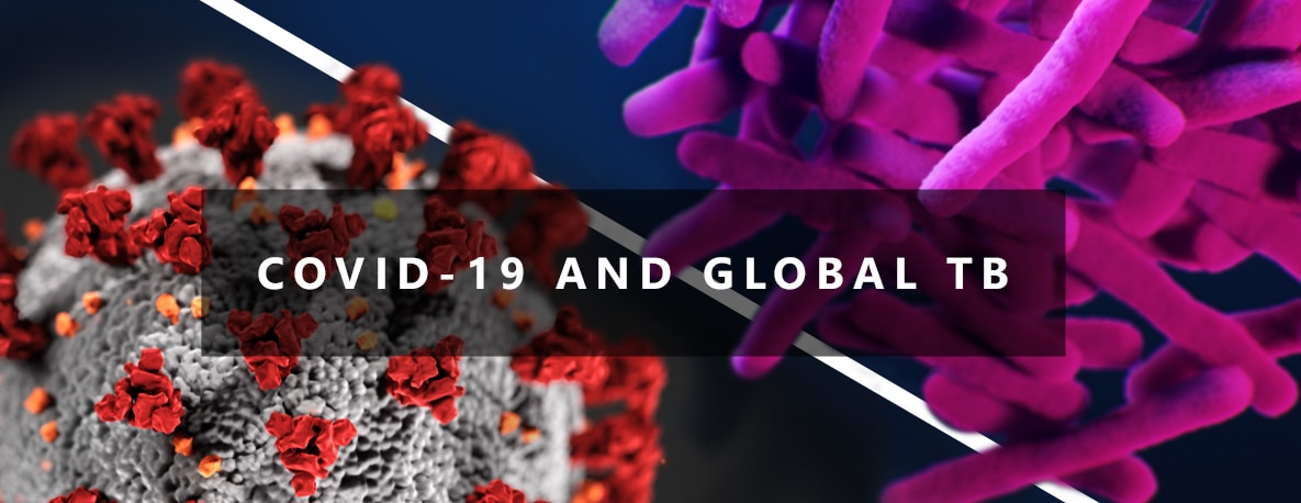 COVID-19 and Global TB