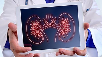 A doctor holds a tablet displaying a kidney illustration