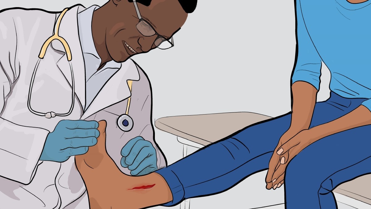 Illustration of a doctor examining an open wound on a female patient's leg.