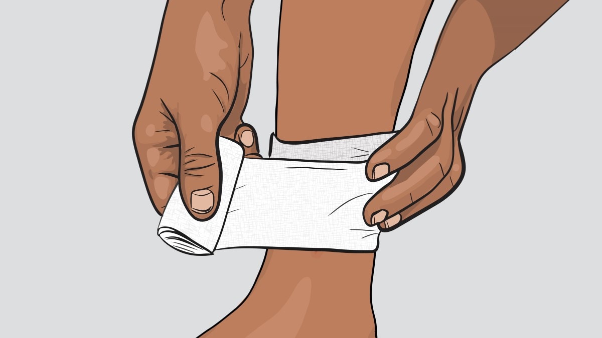 Illustration of a person putting a bandage over an open wound.