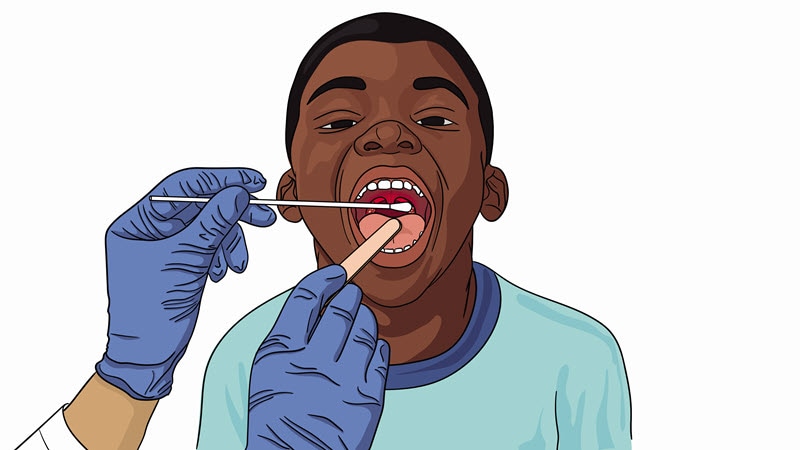 illustration of how a person is tested for strep throat