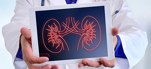 Médico sosteniendo una tableta que muestra una ilustración de los riñones.