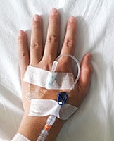 Photo of an iv taped to the top of a hand