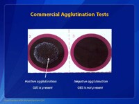 Commercial Agglutination Tests