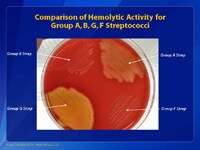 Comparison of Hemolytic Activity for Group A, B, G, F Streptococci