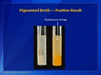 Pigmented Broth — Positive Result
