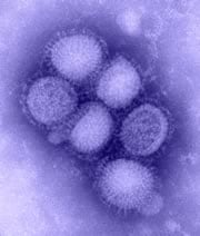 Image of H1N1 influenza virus