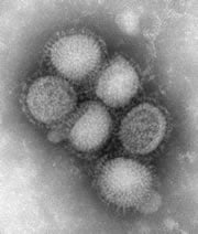 Image of H1N1 influenza virus