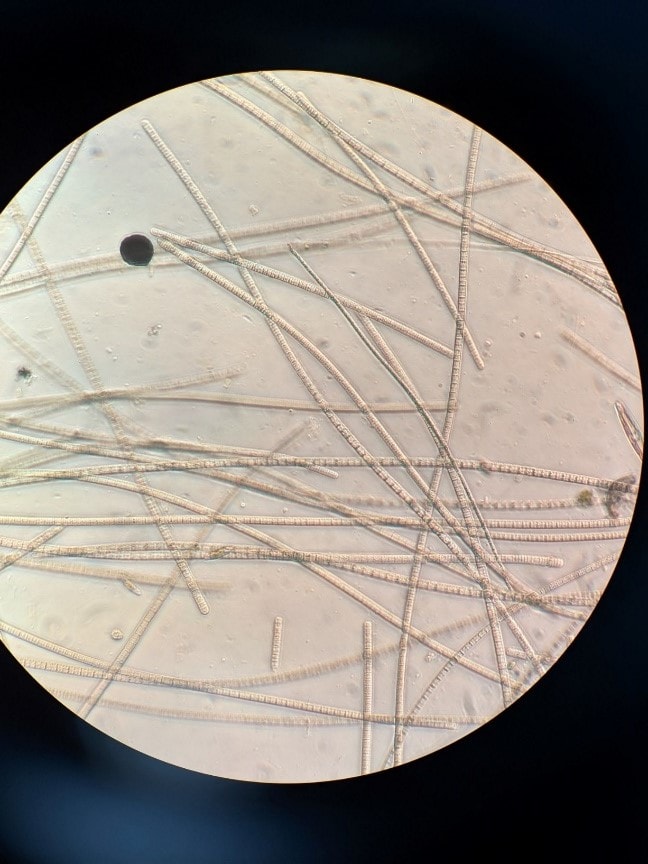 <em>Oscillatoria</em> sp. of cyanobacteria identified from the Michigan pond associated with dog deaths.

Photo credit: Kevin Goodwin, Michigan Department of Environment, Great Lakes, and Energy