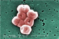 Image result for Acinetobacter baumannii