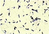 Clostridium sordellii