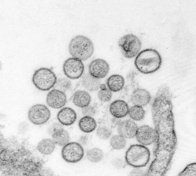 electron micrograph of Sin Nombre virus isolate