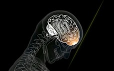 Illustration of a brain hitting the inside of the skull