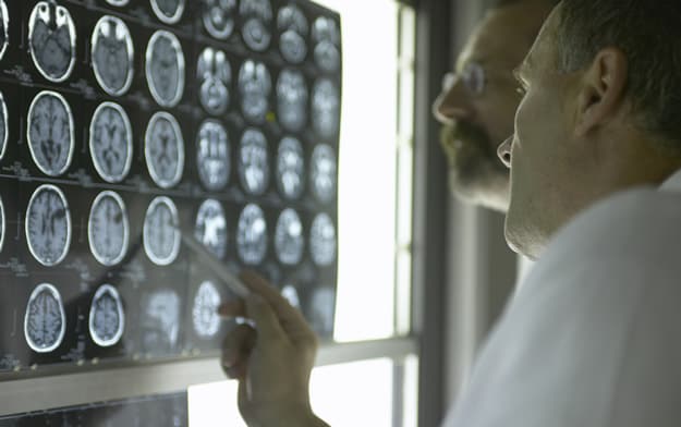 Photo: Doctors looking at brain scans