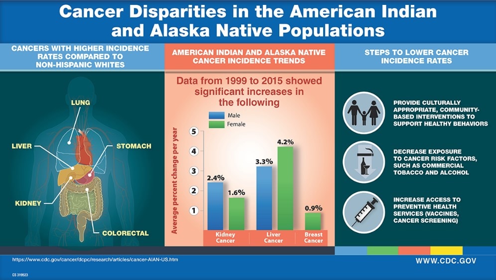 Graphic: Colorectal, Kidney, Liver, Lung and Stomach cancers more prevalent in native americans than whites. Kidney, liver and breast cancer showed significan increase in this population between 1999-2015.