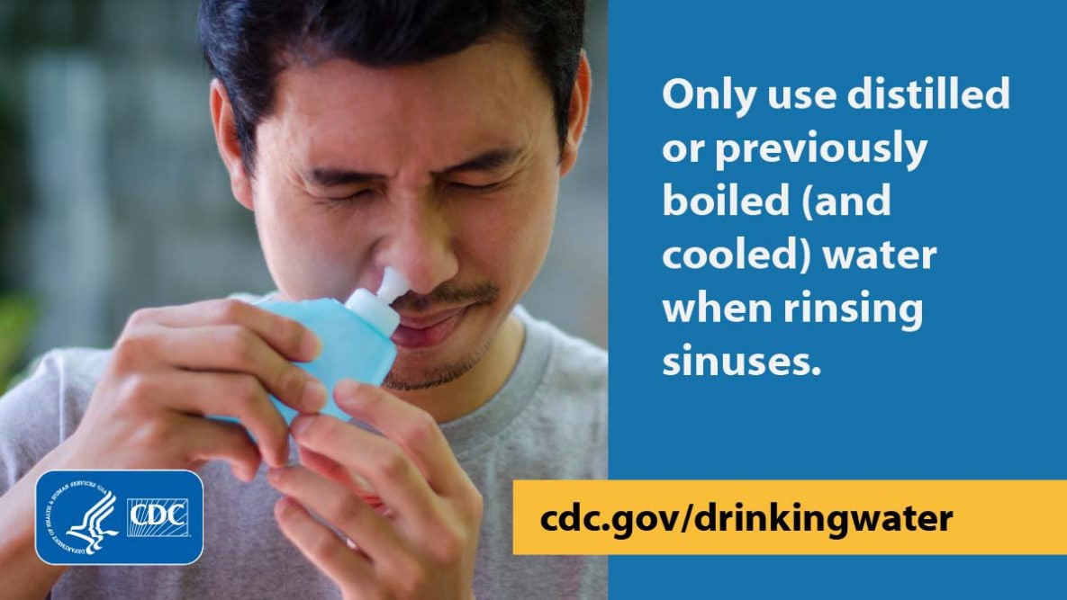 Only use distilled or previously boiled (and cooled) water when rinsing sinuses
