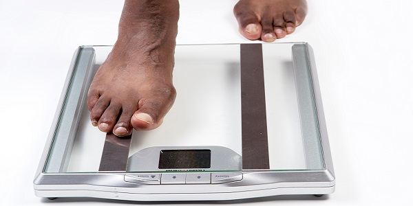 Body Mass Index (BMI)  Healthy Weight, Nutrition, and Physical