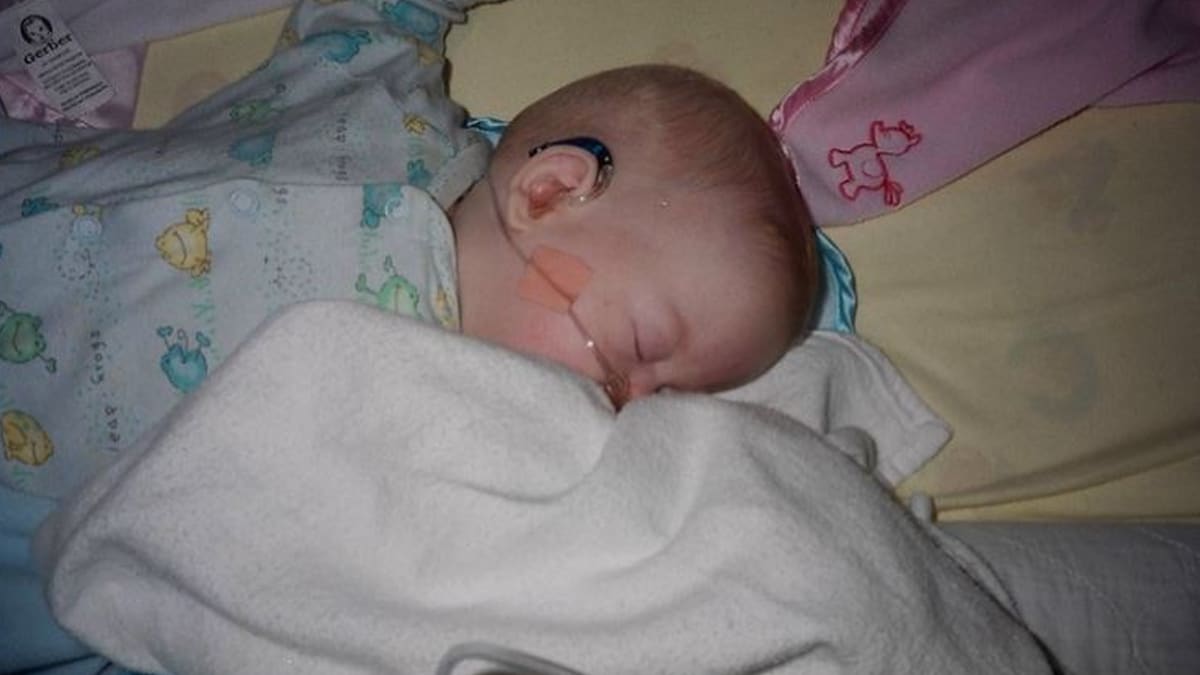 A sleeping baby is wearing an assistive hearing device