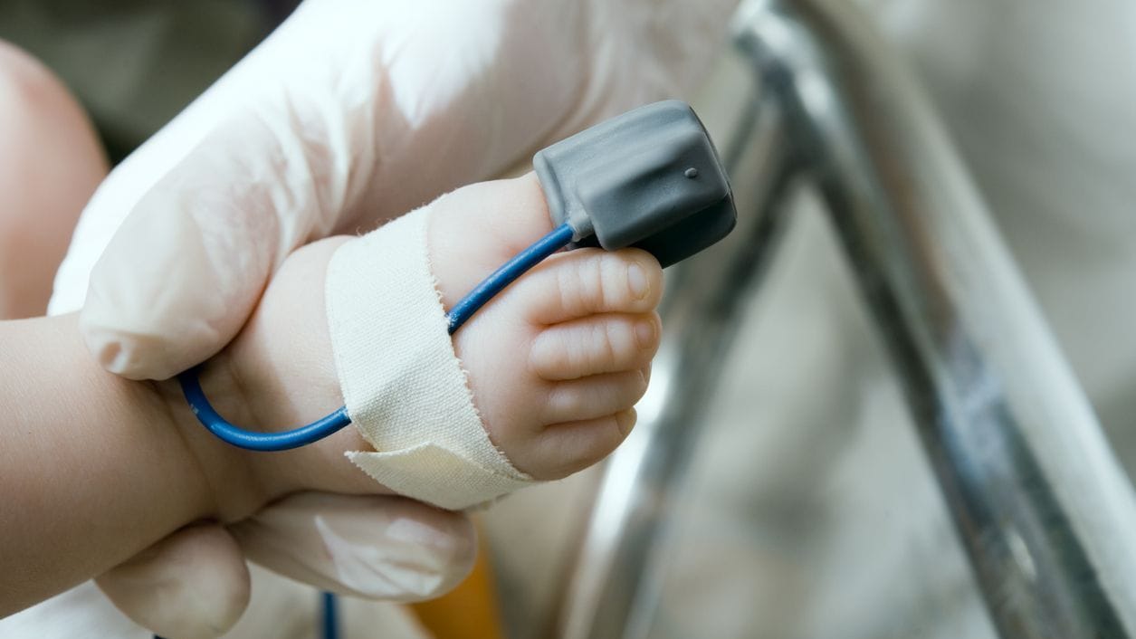A pulse oximeter is attached to a baby's foot