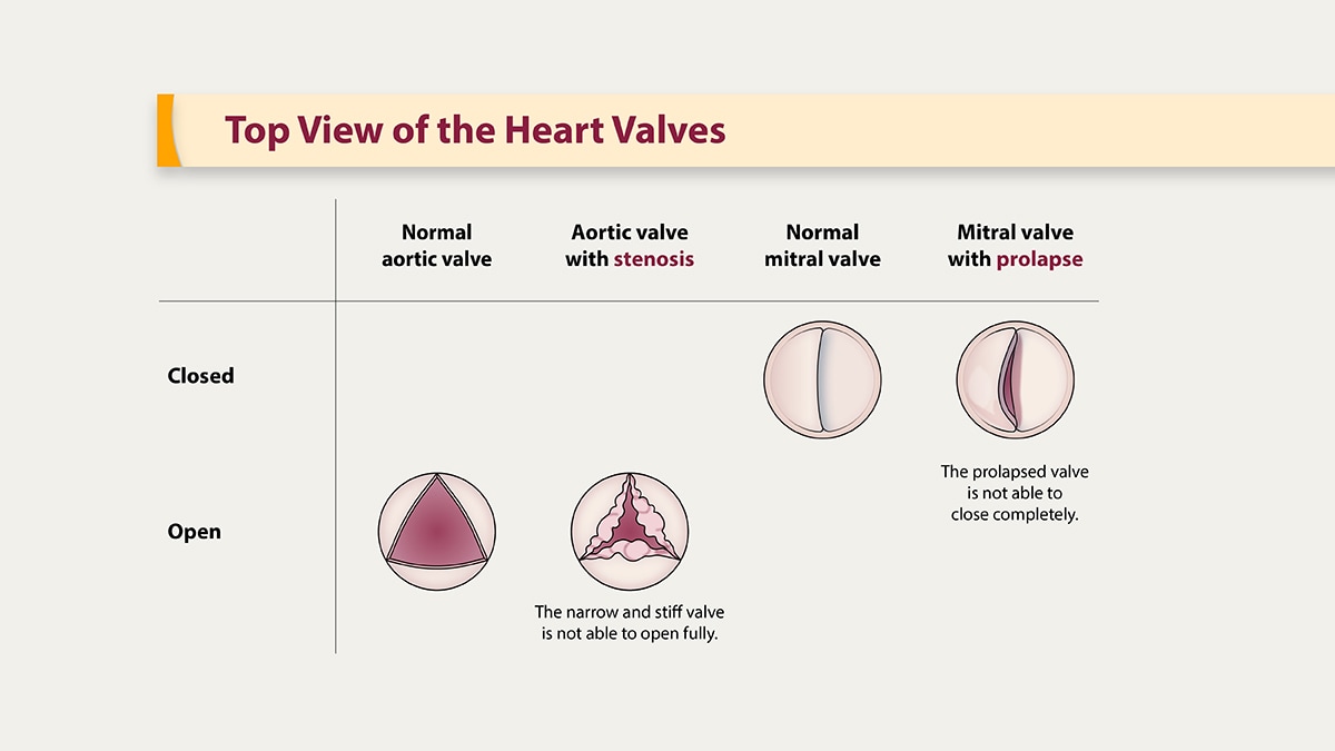 Illustration of the top view of the heart valves.