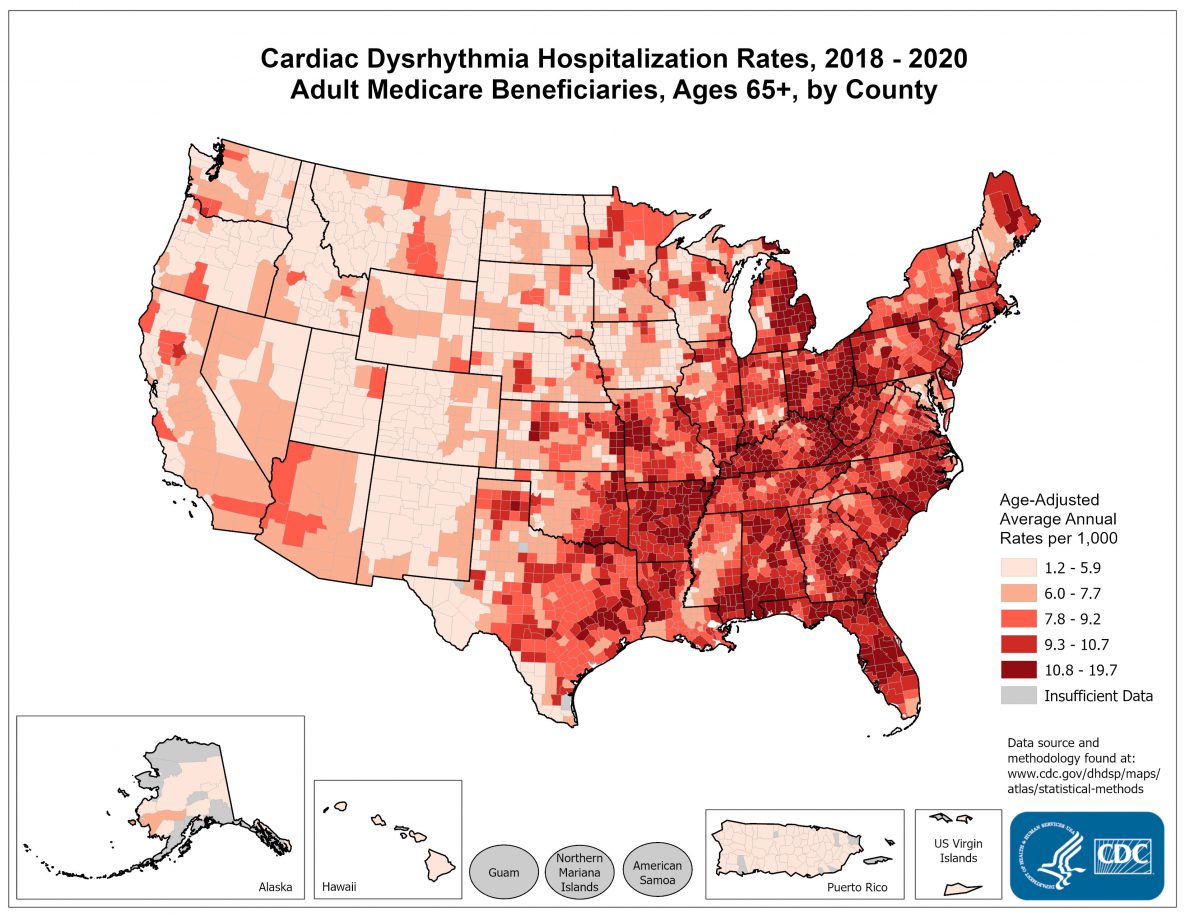 Cardiac Dysrhythmia hospitalization rates for fee-for-service Medicare beneficiaries ages 65 and older were highest in counties in the Northeastern, Eastern, and Southeastern United States. 