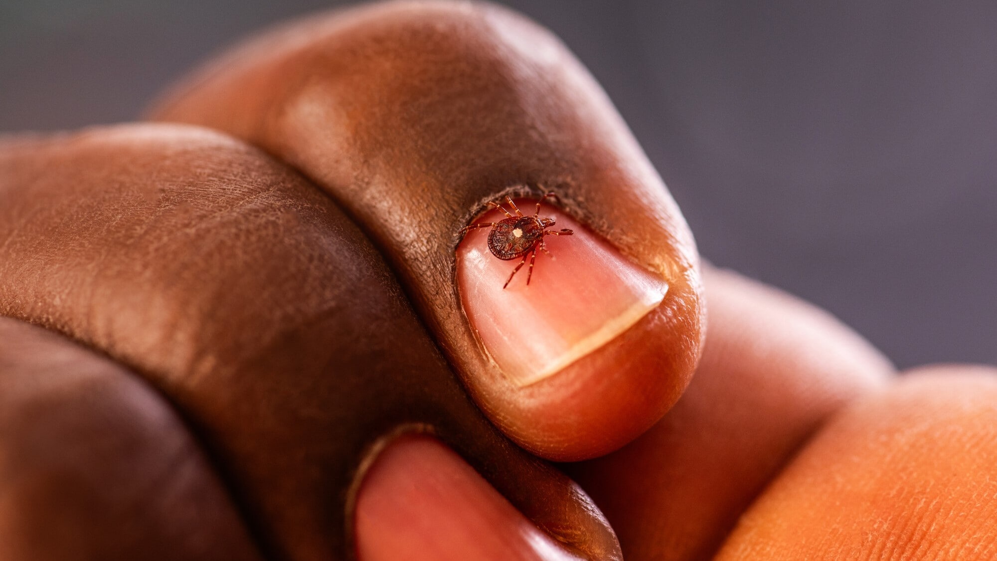 A lone star tick on a person's fingernail.