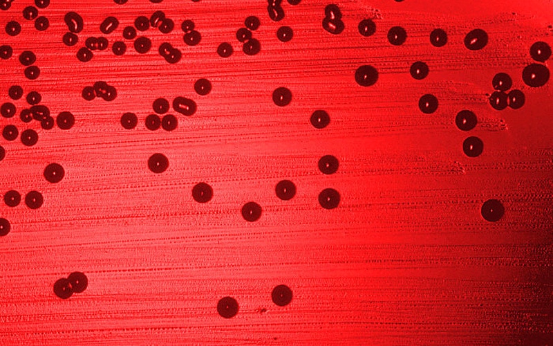Blood agar plate culture of Haemophilus influenzae.