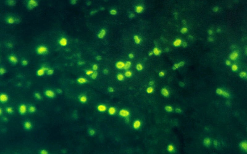 Haemophilus influenzae using immunofluorescence