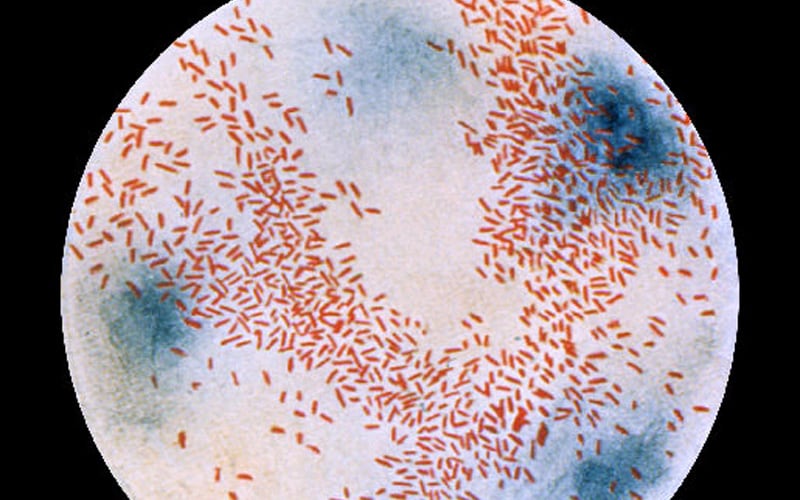 Photomicrograph of Haemophilus influenzae as seen using a Gram-stain technique