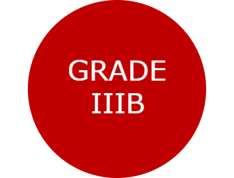 Grade IIIb