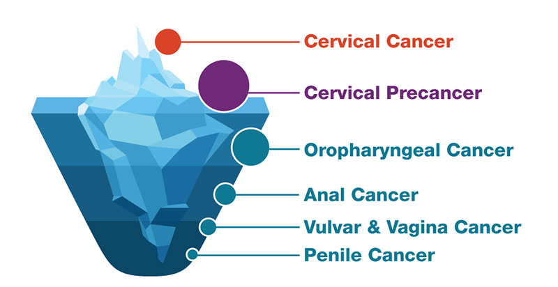HPV Cancers shown by volume within an iceberg illustration