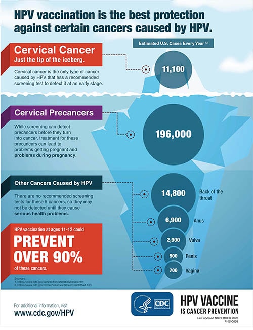 Cancers Caused By Hpv Human Papillomavirus Hpv Cdc