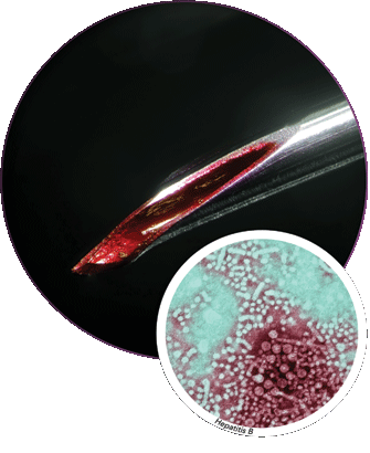 A needle with blood in it and a close view of germs