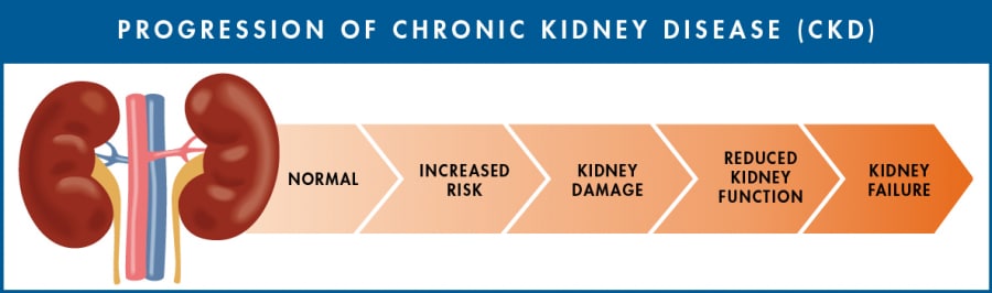 Progression of CKD: Normal - Increased Risk - Kidney Damage - Reduced Kidney Function - Kidney Failure
