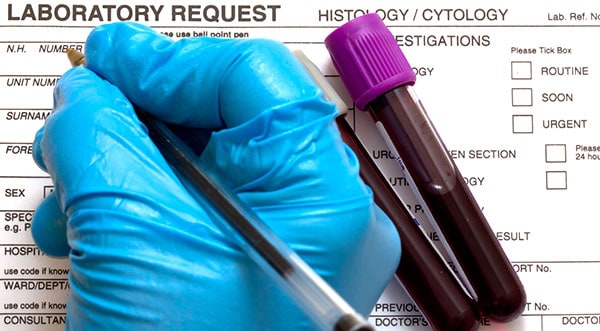 Primer plano de una mano completando un formulario de solicitud de pruebas de laboratorio con dos tubos de muestra de sangre al lado de la mano.