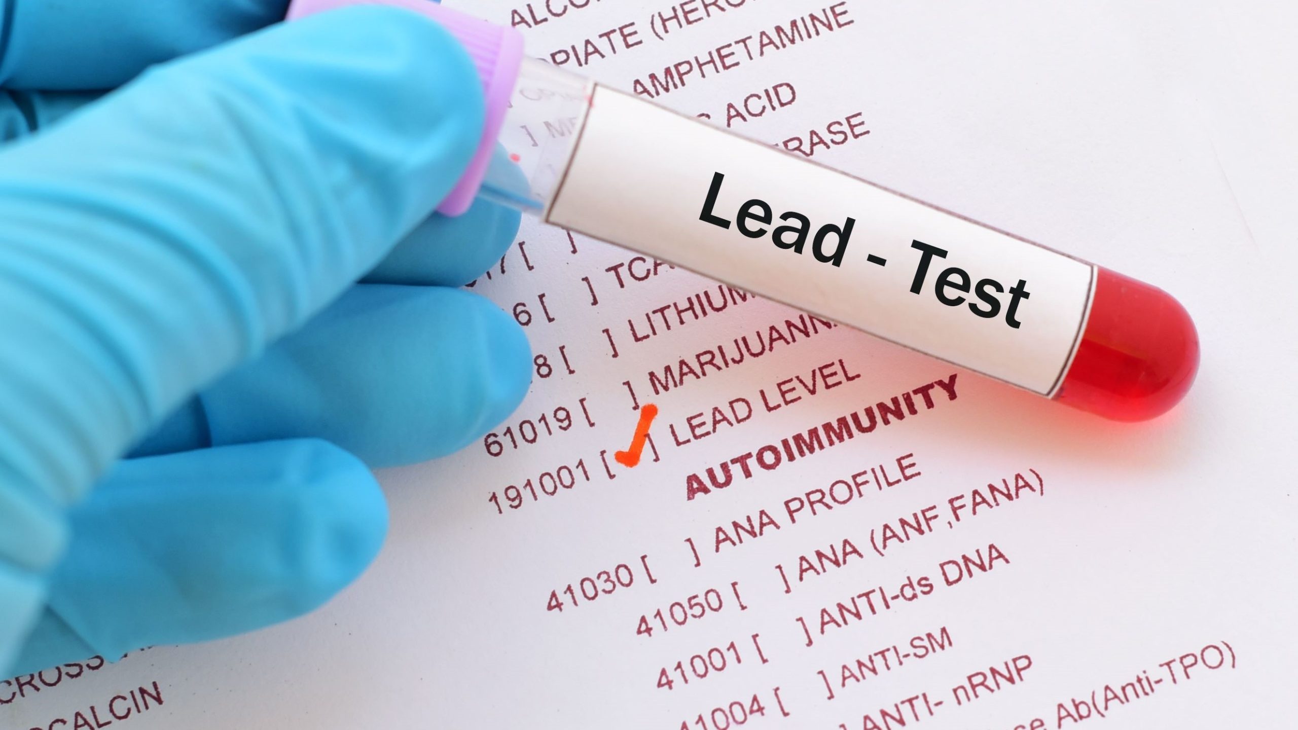 About the Data: Blood Lead Surveillance | Childhood Lead Poisoning ...